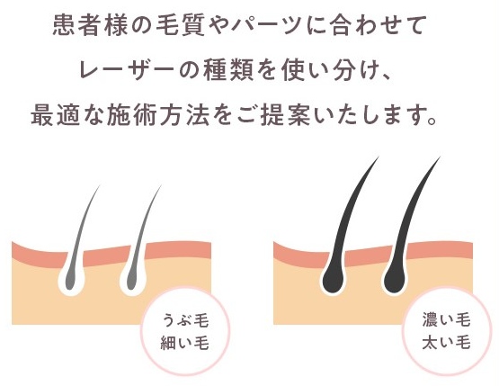 エミナルクリニック　脱毛機