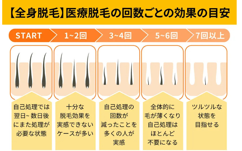 じぶんクリニック　医療脱毛回数